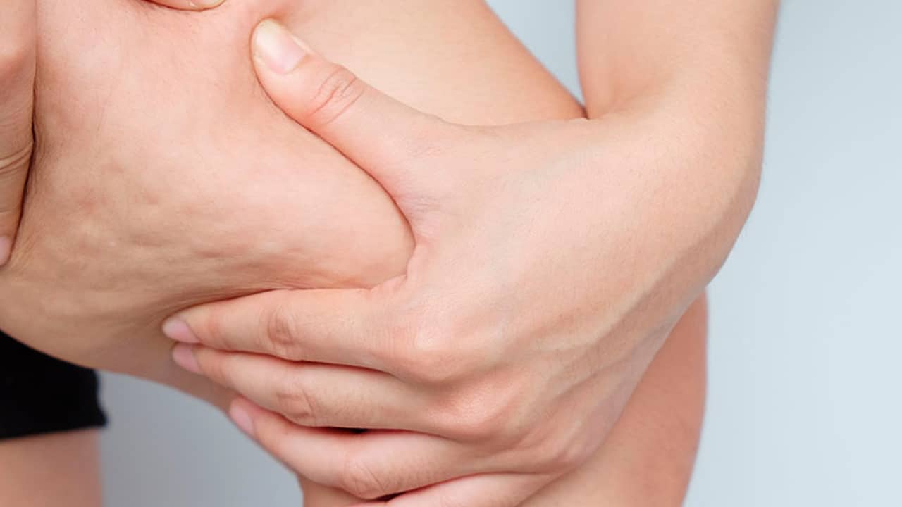 Workshop grabado - CELULITIS: ¿CÓMO LA TRATO?