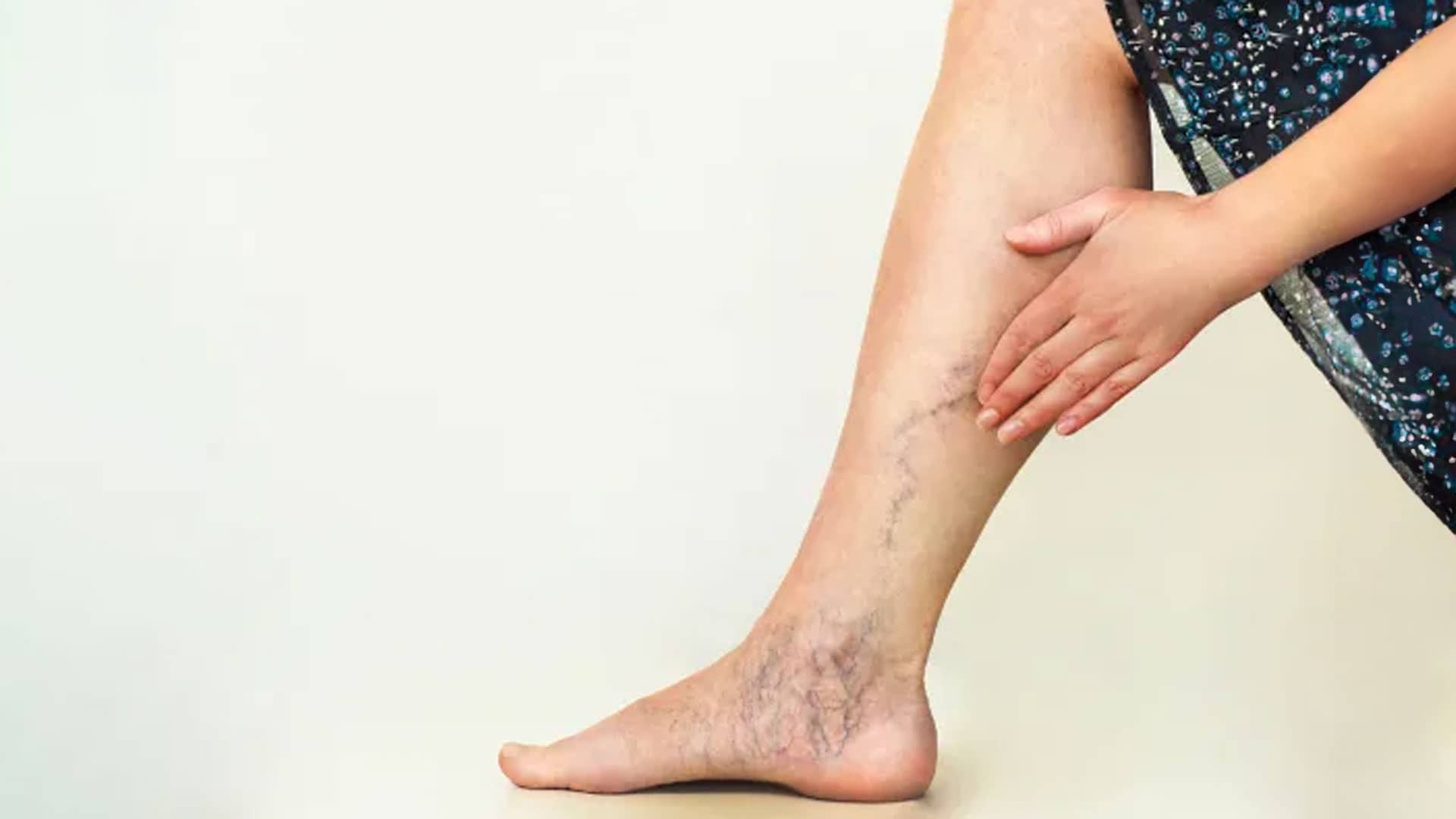 Workshop gravado - COMO ATUAR NO PÓS-OPERATÓRIO DAS CIRURGIAS VASCULARES?