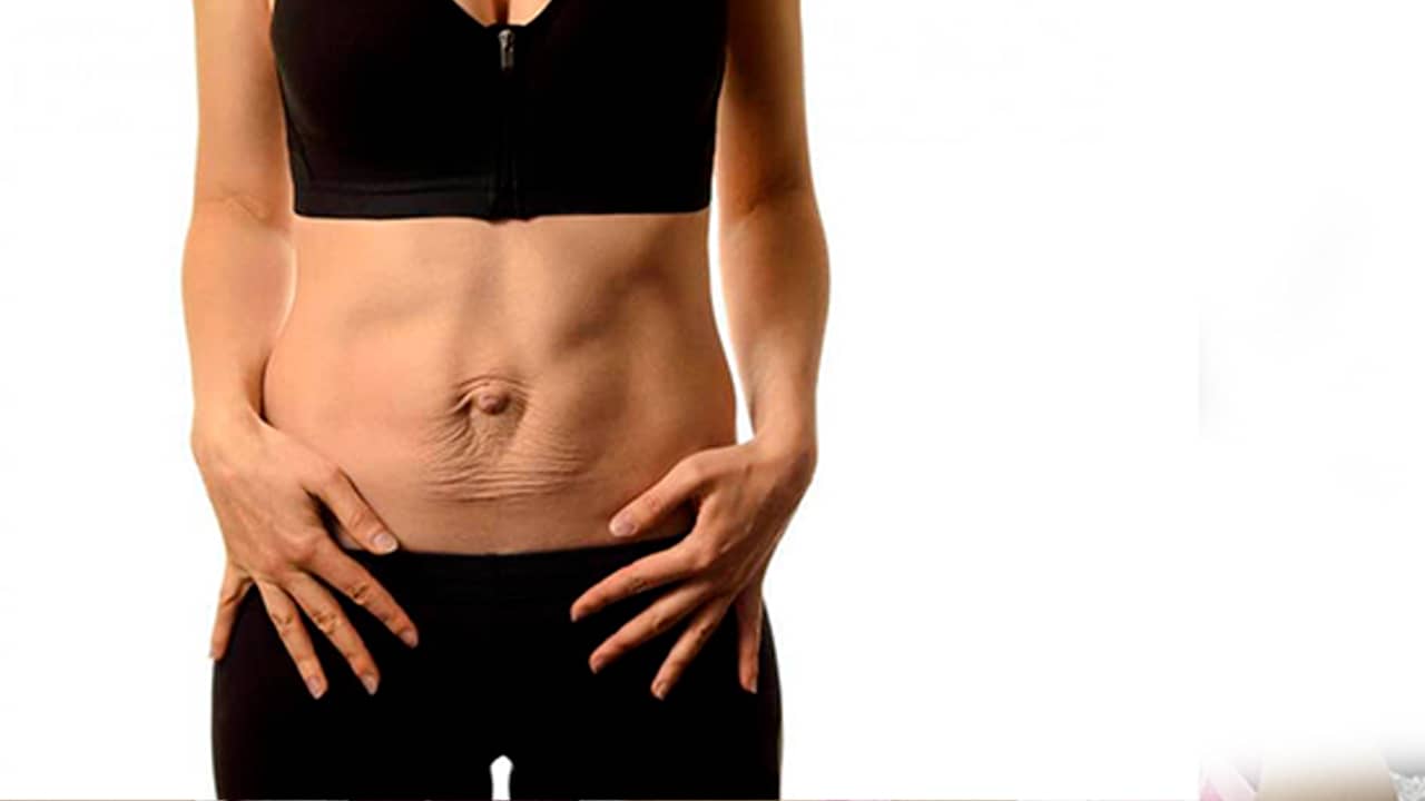 Curso gravado  - ABORDAGEM ESTÉTICA NO PÓS-PARTO