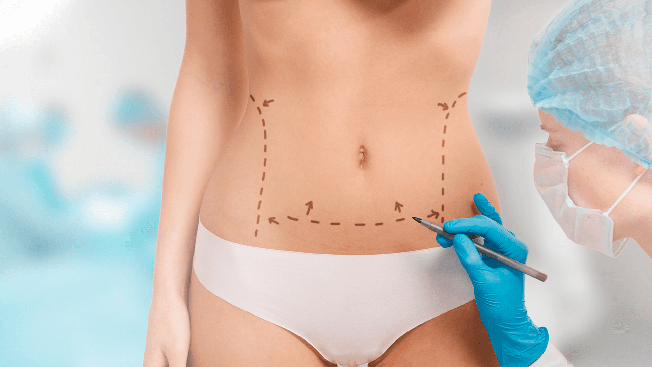 Analysis of modifed ilib therapy in patients submitted to plastic surgery